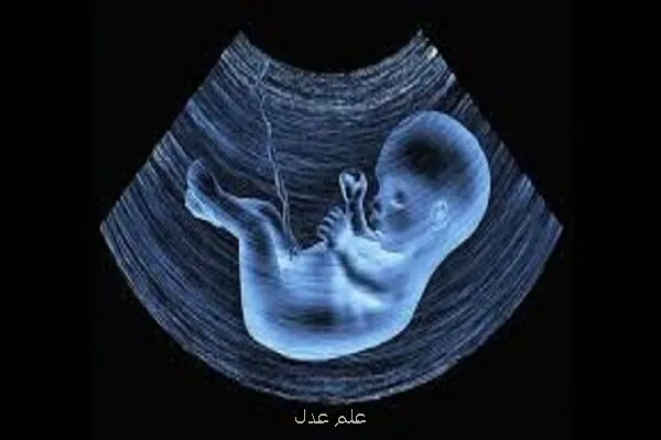 راه اندازی یک سامانه برای گزارش سقط جنین غیرقانونی